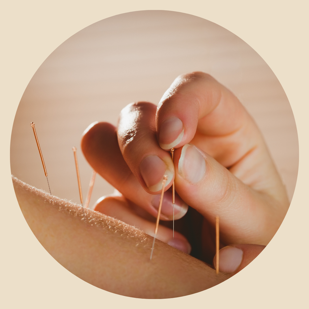 Everything you need to know about Chinese acupuncture